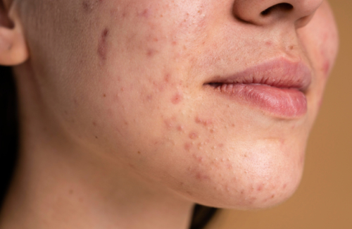 Эстетическая косметология