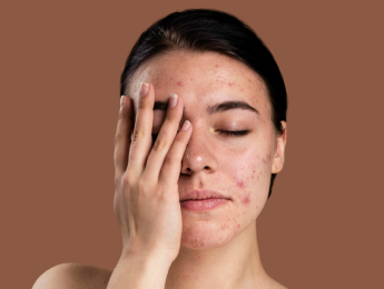 Уход за кожей