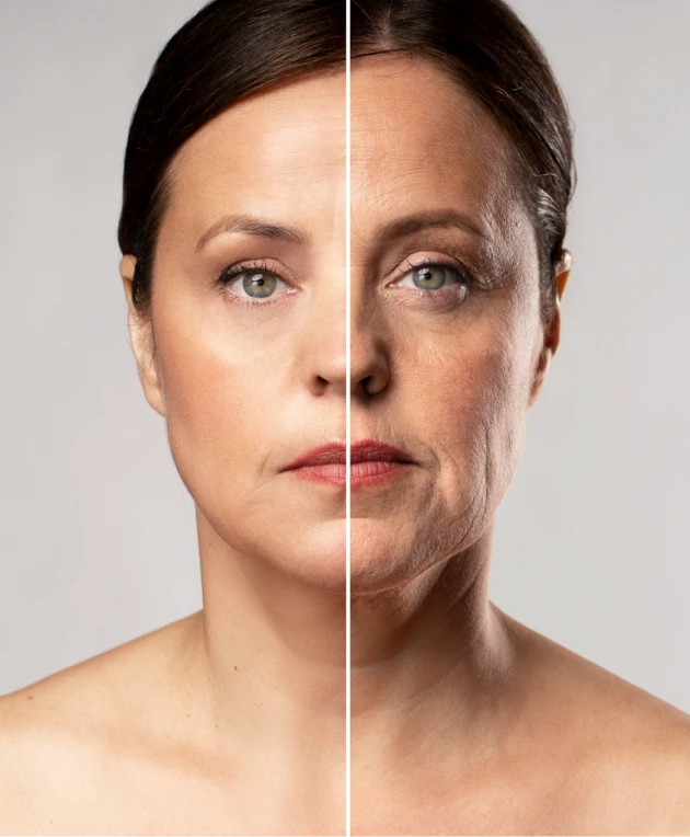 Результат лазерной шлифовки