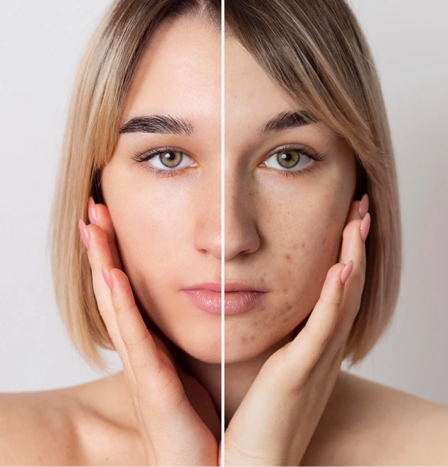 Результат дерматологической хирургии