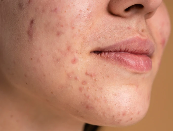 Сыворотка для тела